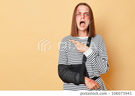 Excited scared woman with bandage has problems with health, has bruised skin standing isolated over beige background pointing at copy space for text. 106073941