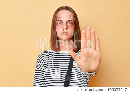 Serious confident sick woman with scratches and bruises on her face standing isolated over beige background showing stop gesture ban to home violence. 106073947
