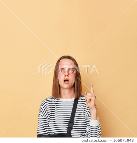 Excited scared woman victim of violence with bruises and injuries wearing striped shirt standing isolated over beige background pointing finger up copy space. 106073948