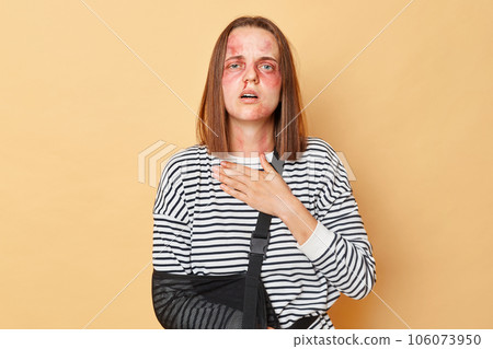 Unhappy stresses sick woman with scratches and bruises on her face standing isolated over beige background felling sadness sorrow fear bad fellings after injuring. 106073950