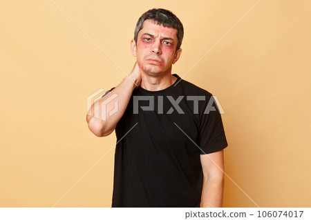 Sad upset beaten man in black T-shirt with bruises and abrasions on his face isolated over beige background suffering from violence feeling pain in neck. 106074017