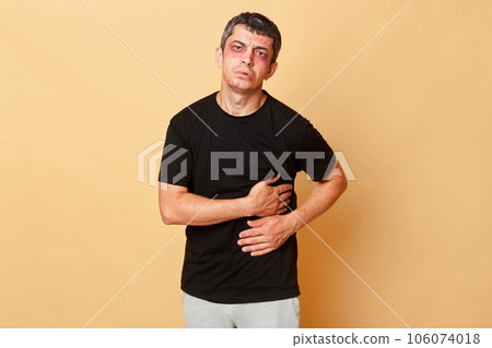 Unhappy injured man in black T-shirt with bruises and abrasions on his face isolated over beige background falling down from stairs having trauma feeling strong pain. 106074018