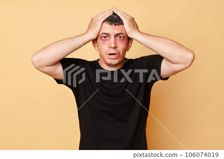 Shocked despair sufferer man in black T-shirt with bruises and abrasions on his face isolated over beige background standing with hands on head has problems with bandits. 106074019
