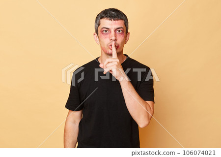Serious mystery beaten man in black T-shirt with bruises and abrasions on his face isolated over beige background keeps finger near mouth keeps silence about violence. 106074021
