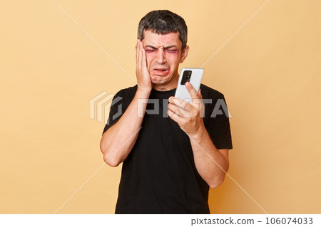 Beaten traumatized man in black T-shirt with bruises and abrasions on his face isolated over beige background holding smartphone calling police touching painful cheek. Beaten traumatized man in black T-shirt with bruises and abrasions on his face isolated over beige background holding smartphone calling police touching painful cheek. 106074033