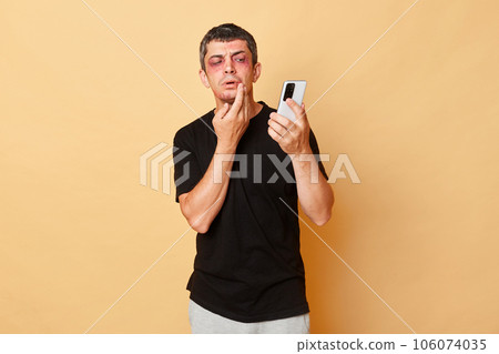 Injured man in black T-shirt with bruises and abrasions on his face isolated over beige background looking at smartphone camera to see his traumas. Injured man in black T-shirt with bruises and abrasions on his face isolated over beige background looking at smartphone camera to see his traumas. 106074035