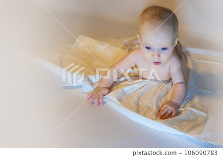 a baby with a hemangioma on his neck lies on a white background 106090783