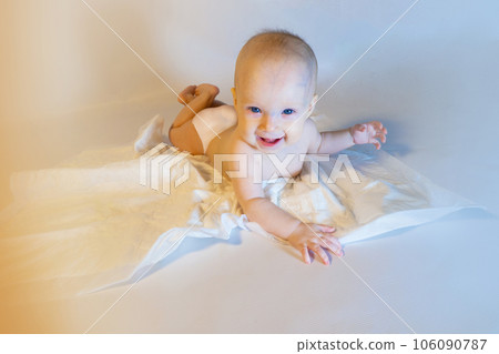 a baby with a hemangioma on his neck lies on a white background 106090787