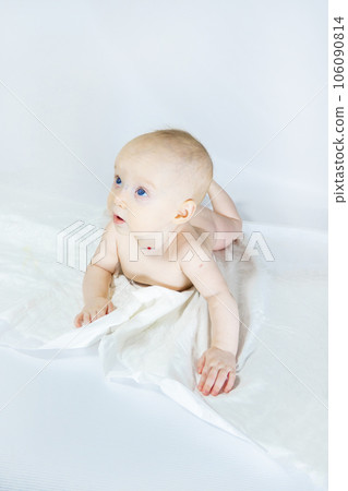 a baby with a hemangioma on his neck lies on a white background a baby with a hemangioma on his neck lies on a white background 106090814