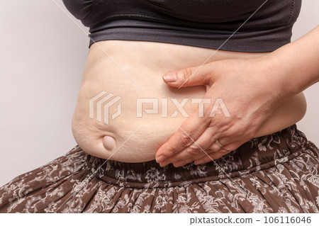 [Debeso with a housewife who picks belly meat] 106116046