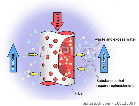 Image illustration of dialyzer 106123397