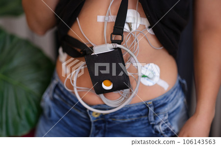 Woman with Holter monitor for daily monitoring of electrocardiogram and blood pressure. 106143563