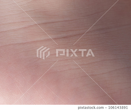 Skin dermatology theme 106143891