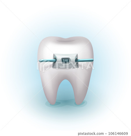 a realistic human white tooth with braces 106146609