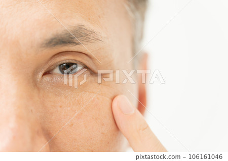 Around the eyes Male Around the eyes Male 106161046
