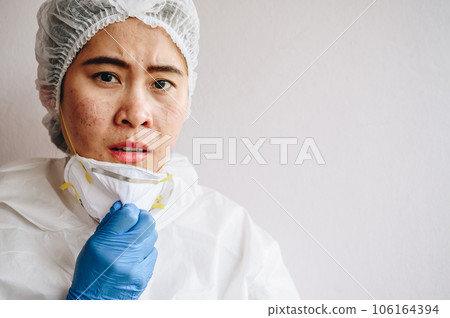 Healthcare worker with acne and facial wounds occur from a medical mask after work for a longtime in hospital during covid-19 pandemic. Wearing mask for prolonged periods can damage the skin. 106164394