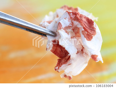 Blood in tissue paper Blood in tissue paper 106183004