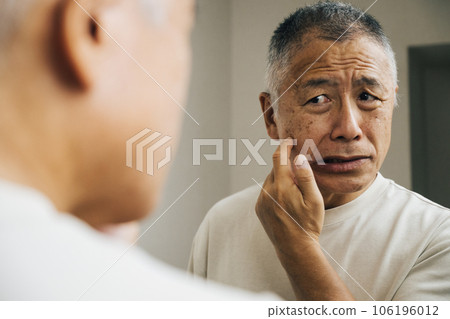 患有皮膚問題的老人 106196012