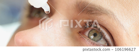 Close-up of middle age woman face and dripping eye drops. Close-up of middle age woman face and dripping eye drops. 106196627
