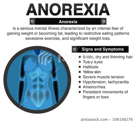 Anorexia (Anorexia) and Its Effects on the Body Anorexia (Anorexia) and Its Effects on the Body 106198276