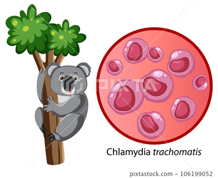 Chlamydia trachomatis with explanation Chlamydia trachomatis with explanation 106199052