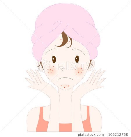 Young woman face with acne skin problem Young woman face with acne skin problem 106212768