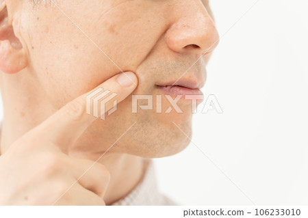 鼻唇溝 嘴角 男性 106233010