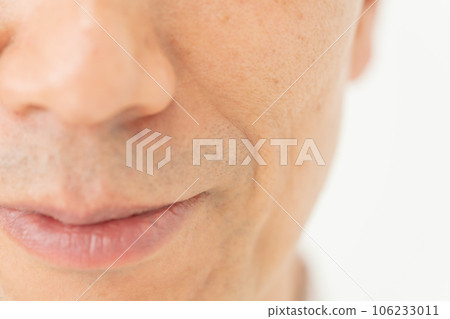 鼻唇溝 嘴角 男性 106233011