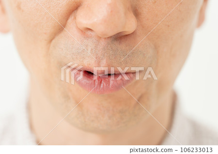 鼻唇溝 嘴角 男性 鼻唇溝 嘴角 男性 106233013