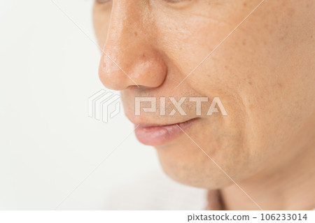 Nasolabial folds Mouth Male Nasolabial folds Mouth Male 106233014