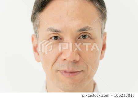 Nasolabial folds Mouth Male 106233015