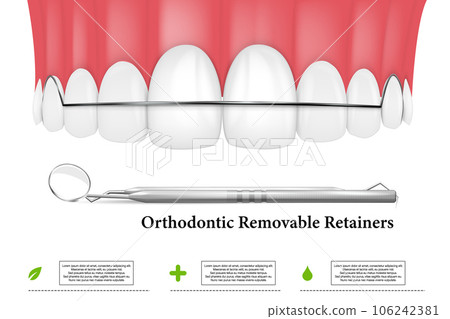 3d render of jaw with orthodontic removable retainer over whte background 3d render of jaw with orthodontic removable retainer over whte background 106242381