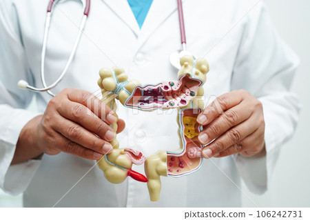 Intestine, doctor holding anatomy model for study diagnosis and treatment in hospital. 106242731