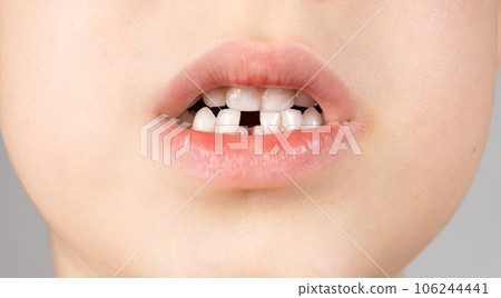 Loss of milk teeth in children. A six-year-old child shows the first baby tooth that has fallen out Loss of milk teeth in children. A six-year-old child shows the first baby tooth that has fallen out 106244441
