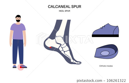 Orthotic shoe and insoles Orthotic shoe and insoles 106261322