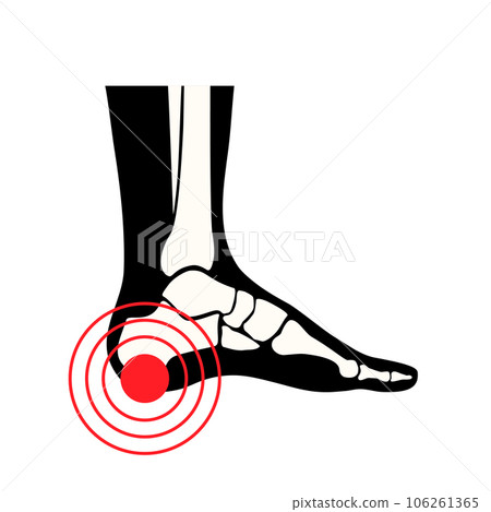 Pain of the heel 106261365