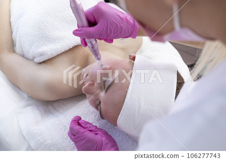 Microneedle mesotherapy. Beautiful young woman receiving microneedling rejuvenation treatment With Dermapen On Face, Cheek Area In Beauty Saloon. Skincare. Horizontal Plane 106277743