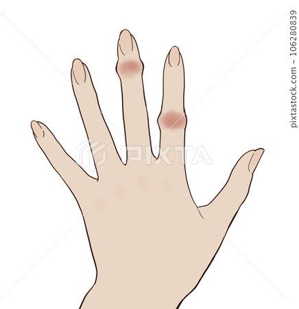 赫伯登節點和布沙爾節點 赫伯登節點和布沙爾節點 106280839