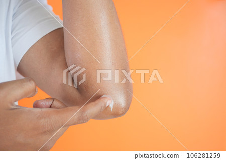 Close up of man hand using petroleum jelly on elbow  106281259