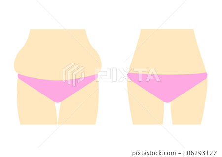 Before and after dieting women 106293127