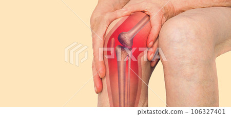 Acute pain in a knee joint, close-up. Color image, isolated on a pastel background. Pain area of red color 106327401