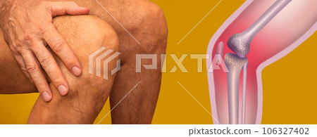 Human anatomy. The structure of the knee joint. 106327402