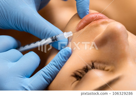 Lip augmentation procedure with hyaluronic acid in a beauty salon. 106329286