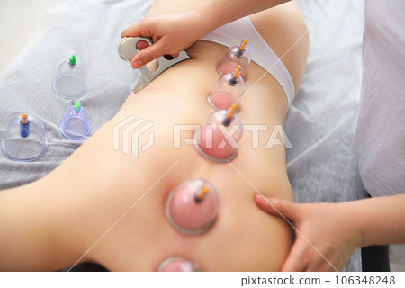 Hijama - method of vacuum bloodletting. The specialist makes cupping therapy for the patient. 106348248