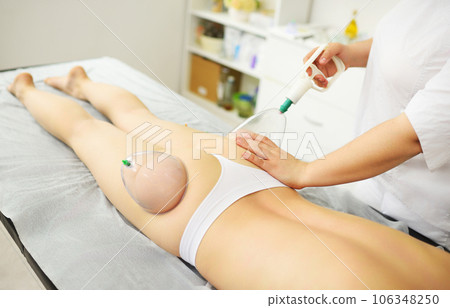 Vacuum massage of the buttocks. Hijama, cellulite removal from problem areas in a modern massage parlor. 106348250