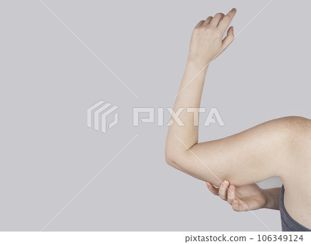 Obesity Cellulite. Sagging flabby skin on a woman arm. Before and after. Concept of losing weight, playing sports, checking result from diet and intense training. Result of losing weight. Liposuction Obesity Cellulite. Sagging flabby skin on a woman arm. Before and after. Concept of losing weight, playing sports, checking result from diet and intense training. Result of losing weight. Liposuction 106349124