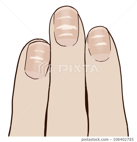 horizontal line of nail 106402785