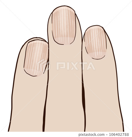 vertical lines on nails 106402788