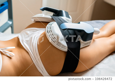 Specialized equipment is positioned on the buttocks of a young woman for precise body sculpting 106426472