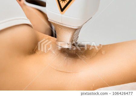 Close up woman gets laser hair removal on her armpit in the salon, Close up woman gets laser hair removal on her armpit in the salon, 106426477